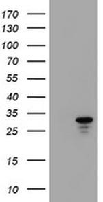 HDHD1 Antibody in Western Blot (WB)