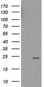 HDHD1 Antibody in Western Blot (WB)