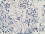 HDHD2 Antibody in Immunohistochemistry (Paraffin) (IHC (P))