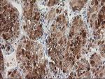 HDHD2 Antibody in Immunohistochemistry (Paraffin) (IHC (P))