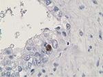 HDHD2 Antibody in Immunohistochemistry (Paraffin) (IHC (P))