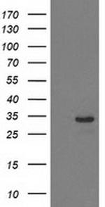 HDHD2 Antibody in Western Blot (WB)