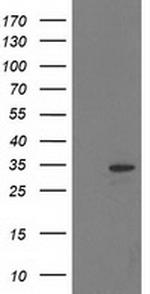 HDHD2 Antibody in Western Blot (WB)