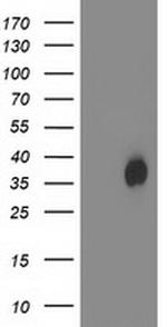 HDHD2 Antibody in Western Blot (WB)