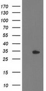 HDHD2 Antibody in Western Blot (WB)