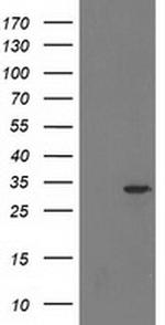 HDHD2 Antibody in Western Blot (WB)