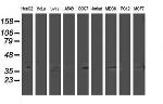 HDHD2 Antibody in Western Blot (WB)