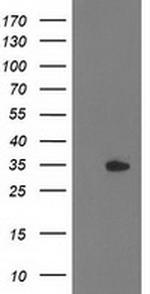 HDHD2 Antibody in Western Blot (WB)