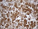 HDHD3 Antibody in Immunohistochemistry (Paraffin) (IHC (P))