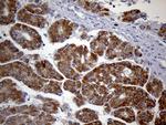 HDHD3 Antibody in Immunohistochemistry (Paraffin) (IHC (P))