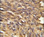 HDLBP Antibody in Immunohistochemistry (IHC)