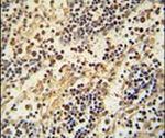 HEMK1 Antibody in Immunohistochemistry (IHC)