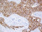 Her-2/neu Antibody in Immunohistochemistry (Paraffin) (IHC (P))