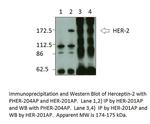 ErbB 2 Polyclonal Antibody
