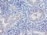 HES1 Antibody in Immunohistochemistry (Paraffin) (IHC (P))