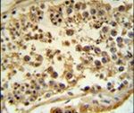 HFE Antibody in Immunohistochemistry (IHC)