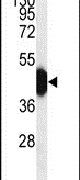 HFE2 Antibody in Western Blot (WB)