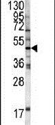 HFE Antibody in Western Blot (WB)