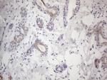 HGF Antibody in Immunohistochemistry (Paraffin) (IHC (P))