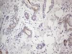 HGF Antibody in Immunohistochemistry (Paraffin) (IHC (P))
