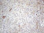 HGF Antibody in Immunohistochemistry (Paraffin) (IHC (P))