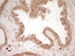 HGF Antibody in Immunohistochemistry (Paraffin) (IHC (P))