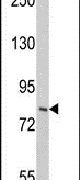 HGS Antibody in Western Blot (WB)