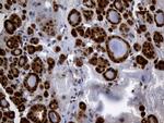 HHLA3 Antibody in Immunohistochemistry (Paraffin) (IHC (P))