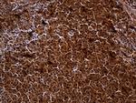 HHLA3 Antibody in Immunohistochemistry (Paraffin) (IHC (P))