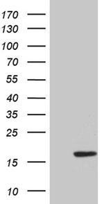HHLA3 Antibody in Western Blot (WB)