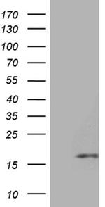 HHLA3 Antibody in Western Blot (WB)