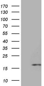HHLA3 Antibody in Western Blot (WB)
