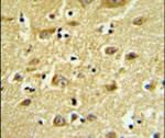 HIAT1 Antibody in Immunohistochemistry (IHC)