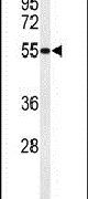 HIAT1 Antibody in Western Blot (WB)