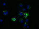 HIBCH Antibody in Immunocytochemistry (ICC/IF)