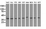 HIBCH Antibody in Western Blot (WB)