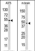 HIF1AN Antibody in Western Blot (WB)