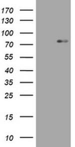 HIF3A Antibody in Western Blot (WB)