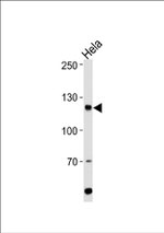 HIRA Antibody in Western Blot (WB)