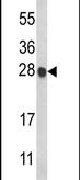Histone H1.2 Antibody in Western Blot (WB)