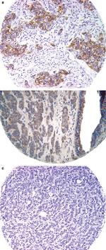 E-cadherin Antibody in Immunohistochemistry (Paraffin) (IHC (P))