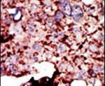 HK1 Antibody in Immunohistochemistry (IHC)