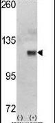 HK1 Antibody in Western Blot (WB)
