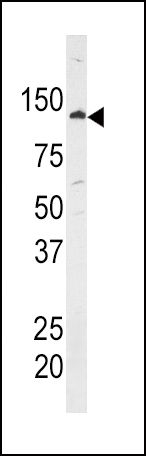 HK1 Antibody in Western Blot (WB)