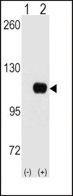 HK1 Antibody in Western Blot (WB)