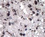 HK2 Antibody in Immunohistochemistry (IHC)