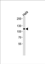 HK2 Antibody in Western Blot (WB)