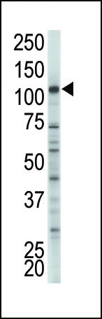 HK2 Antibody in Western Blot (WB)