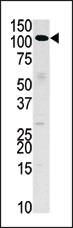 HK3 Antibody in Western Blot (WB)