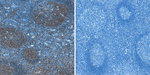 HLA-DR Antibody in Immunohistochemistry (Paraffin) (IHC (P))